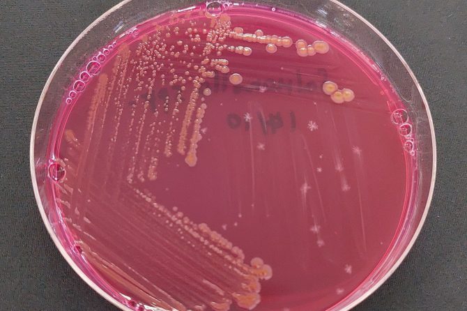 การทดสอบหาเชื้อจุลินทรีย์ที่ทำให้เกิดโรค ของภาชนะบรรจุที่ทำจากพลาสติก 